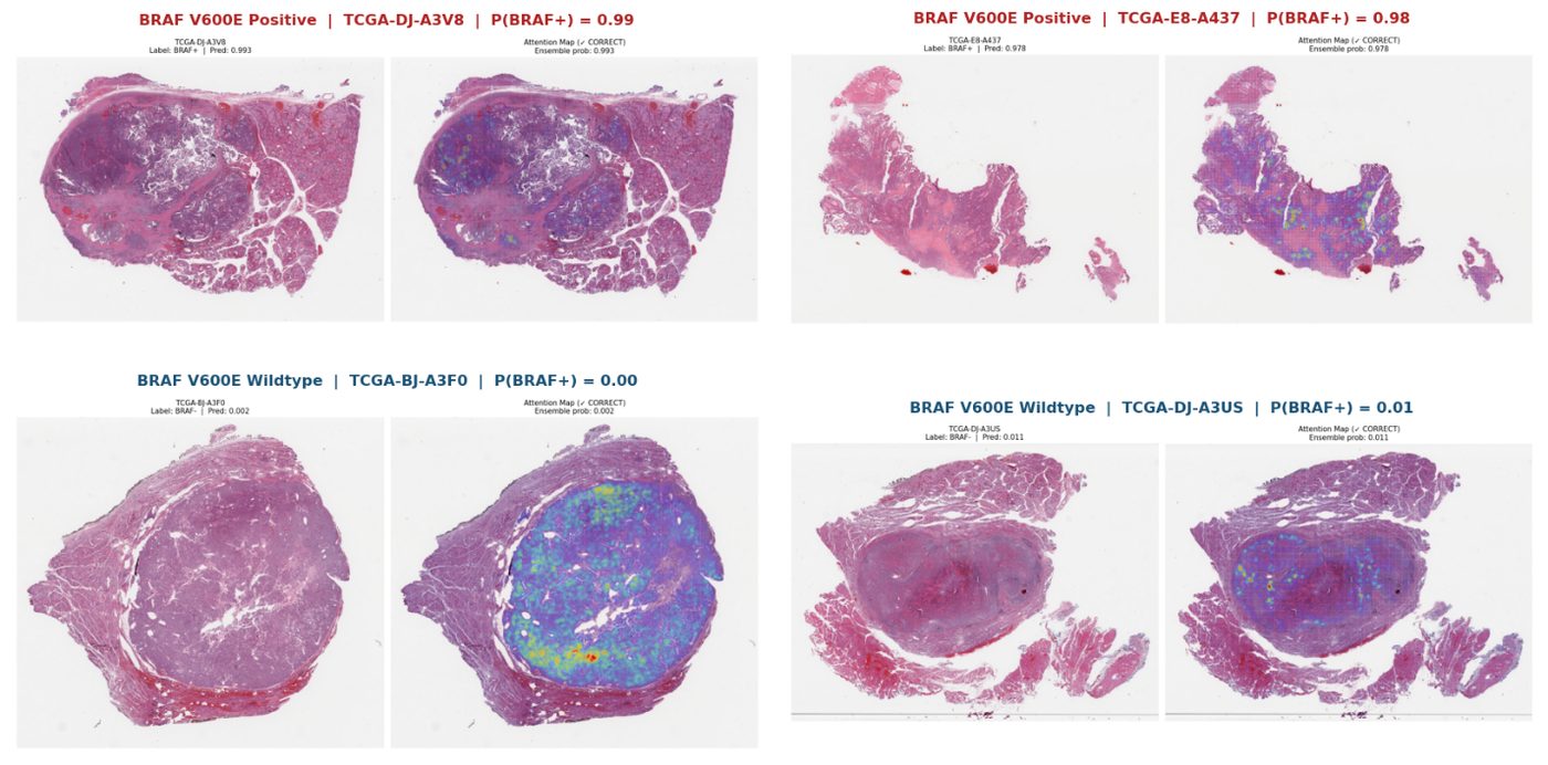 BRAF V600E attention heatmaps -- BRAF+ and wildtype cases