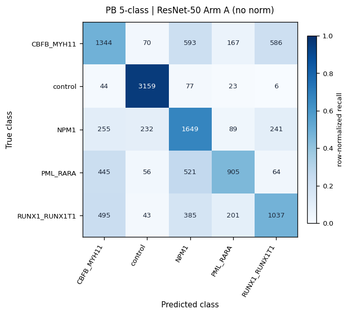Row-normalized confusion matrix for the peripheral-blood AML subtype classifier