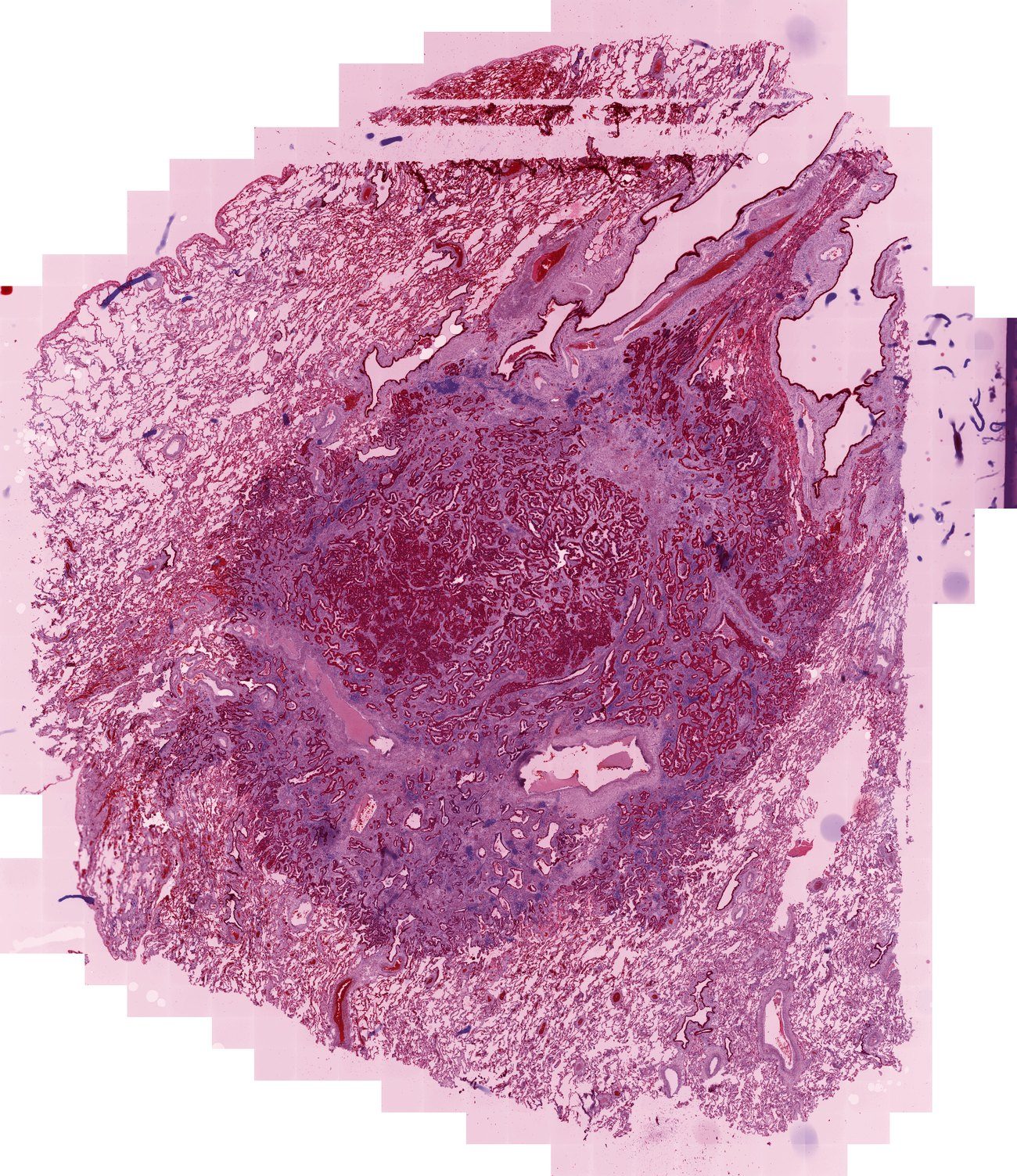 Virtual H and E rendered from an 8-channel multiplex immunofluorescence whole slide image