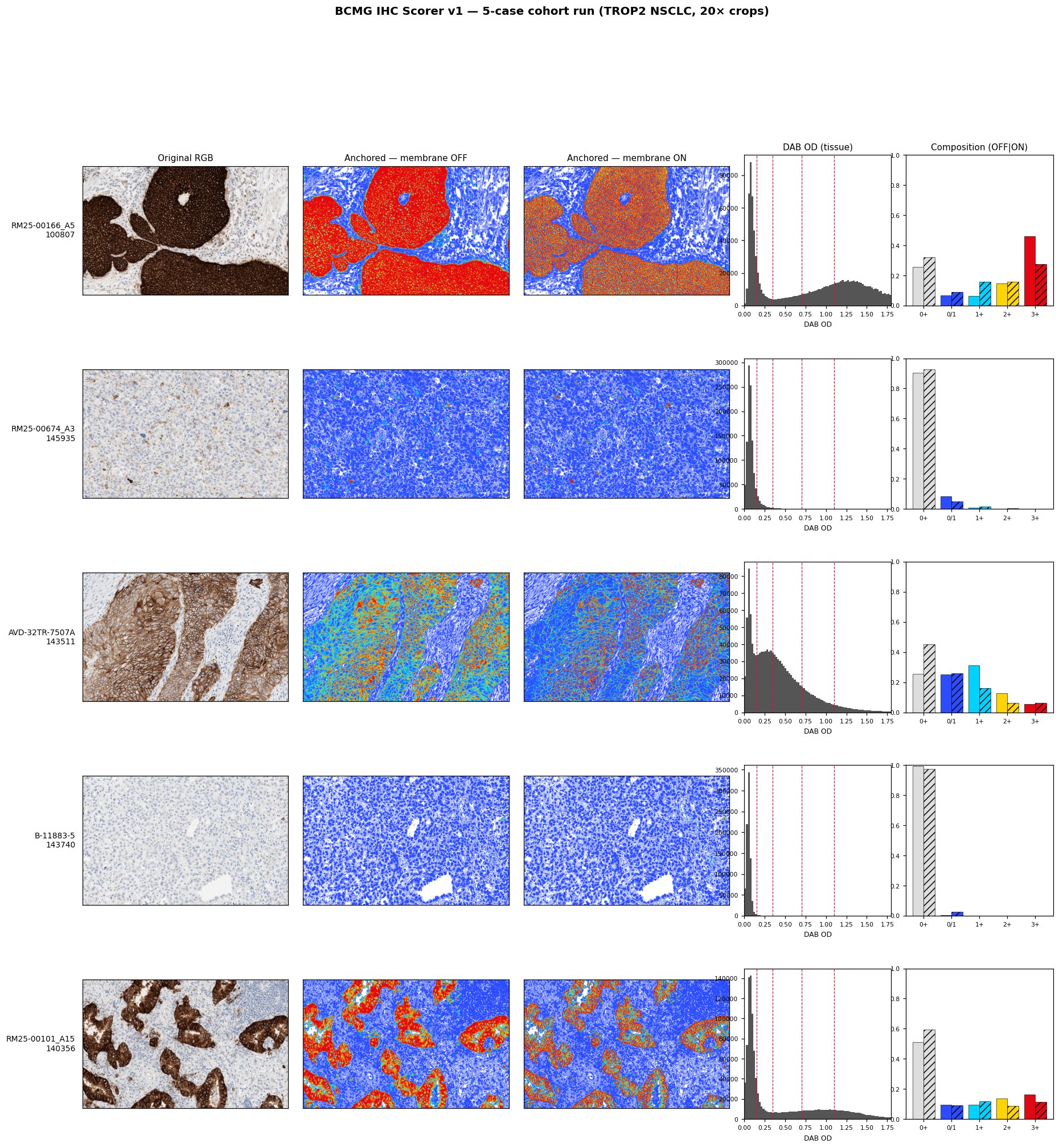 5-case TROP2 NSCLC cohort run -- full dynamic range