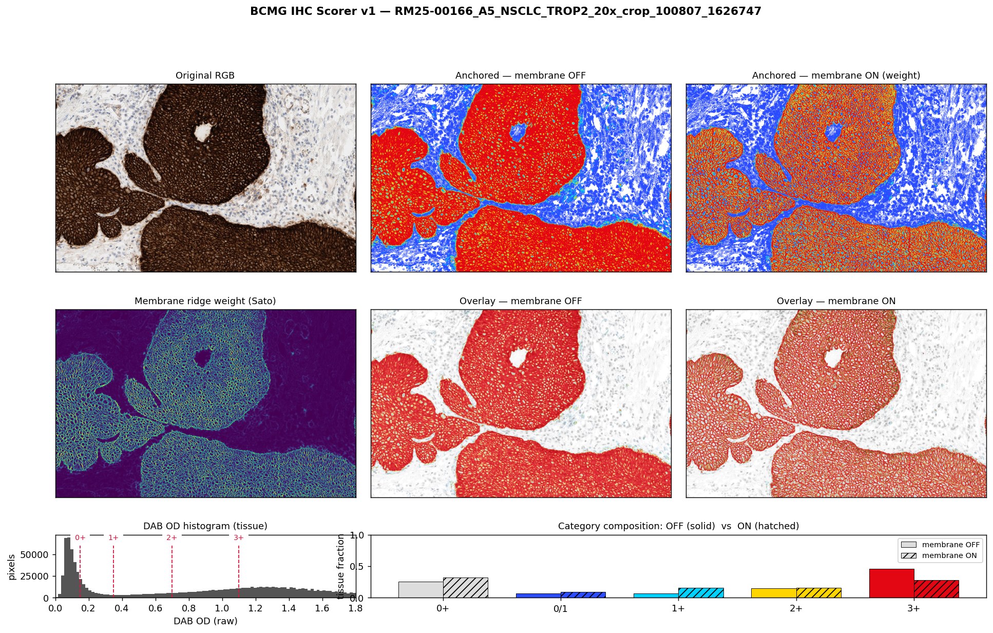 RM25-00166_A5 extreme staining